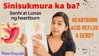 Sinisikmurang BUNTIS | Heartburn/Acidity/Acid reflux/GERD
