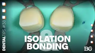 Optimal anterior isolation & bonding