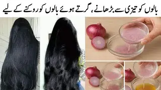 Onion Shampoo For Hair Fall | Strong Thick Long Hair | Patly Kamzor Girty Balon K Liy Piyaz Shampoo