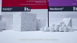 Neobone and Trioss  synthetic bone Graft
