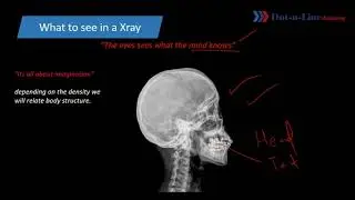 All about XRAYS | What is X-Ray | How X Rays are formed | How to see a XRay film.