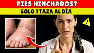Pies Hinchados: La Verdad que Nadie le Dice (No es Sal)