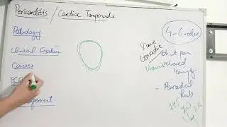 ACUTE PERICARDITIS with 15+ MCQs in easiest way