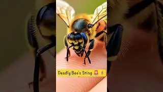 Bee's Deadly Sting #shorts #beesting #misspanghal