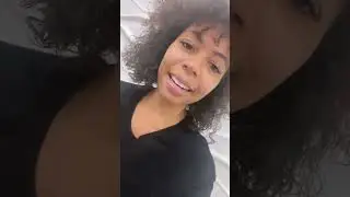 Invisalign review part 2