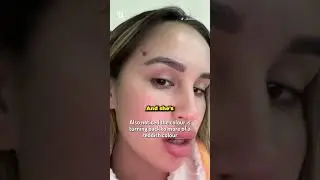 Катастрофа с лисьим глазом!