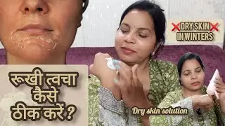 रूखी त्वचा को कैसे करें ठीक? How to fix Dry skin ❌Dry skin ❌ in winters| Angelskin cream demo+review