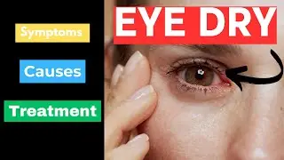 Say Goodbye to Dry Eyes: Best Treatments & Tips You Need to Know!