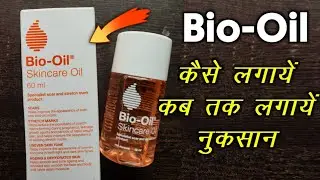 Bio-Oil Full Review ~ कैसे लगाए, कबतक लगाना है, नुकसान ? Hindi Review #bio-oil