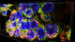 21-Month Human Lung 17235 SFTPB and ABCA3 Enhanced Resolution_003