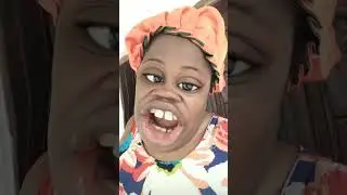 stop bleaching cream #trendingshorts #short #funny #shortsfeed