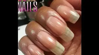 Nail Ridges? Treat Them W/ This Moisturizing Soak!