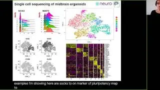 Rhalena Thomas &mdash; HBHL Research Day 2020 Flash Talk