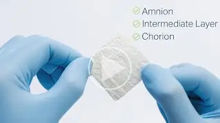 Revita: The Next Generation Placental Allograft