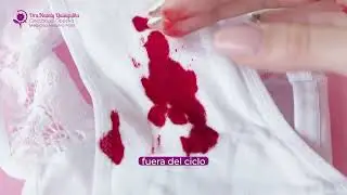 Tipos de Cáncer Ginecológico - Dra. Nataly Quisiguiña - Ginecóloga Obstétra en Riobamba 2026