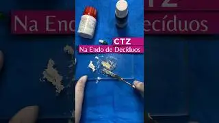 Voc&ecirc; conhece o CTZ? #odontopediatria