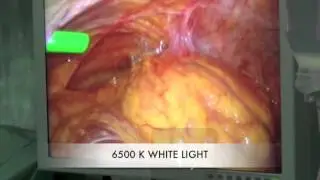 NOVA PROBE LIGHT SOURCE