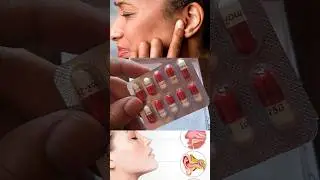 Amoxicillin 250mg Capsule uses,आंख कान गले के इन्फेक्शन #trending #shorts