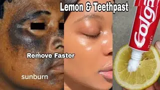 Colgate toothpaste for face whitening | Lemon and colgate