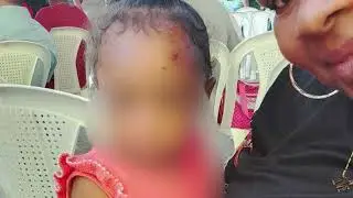 Mother Alleges Police Stalling After Crowbar Attack