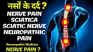 Nerve pain ? Homeopathy medicine for any nerve pain  sciatica sciatic nerve neuropathic pain