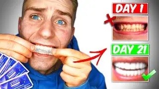 Crest 3D White Strips! Do They Work? 21 day challenge