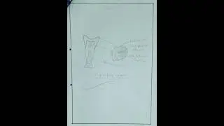 Assignment On Bone Marrow Aspiration. # BSc Nursing for Nursing Students (MSN)