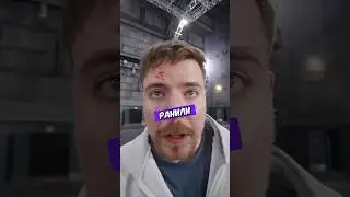 Мистера Биста РАНИЛИ Во Время Съемок!!😱#mrbeast #feastables #a4