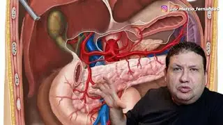 Dreno na barriga após CIRURGIA DE PEDRA NA VESÍCULA
