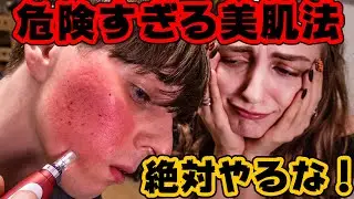 【閲覧注意】本当に効くけど絶対やるな！セルフダーマペン！