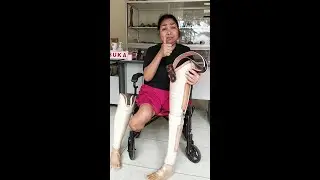 SEDiH !! KEDUA KAKI KU SUDAH DI AMPUTASI...
