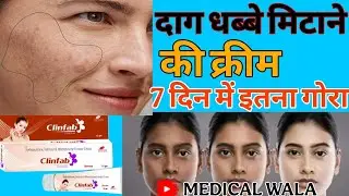Clinfab cream uses in hindi | clinfeb cream | pigmentation cream | क्लिनफेब क्रीम | medical wala