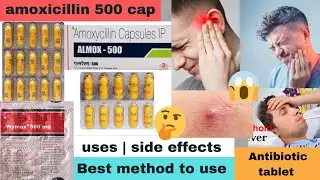 amoxicillin 500mg capsule|दांत का दर्द की दवा|mox 500 capsule|wymox 500mg capsules|almox