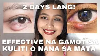 EFFECTIVE NA GAMOT SA KULITI O NANA SA MATA | HOME REMEDIES
