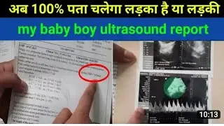 Ultrasound से कैसे पता लगाएं लड़का है या लड़की | Baby Boy or Girl Symptoms During Pregnancy