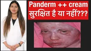 Panderm ++ cream | Panderm cream | Panderm plus cream review | Panderm cream side effects treatment