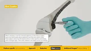 Pangea | Distal Femur Surgical Animation
