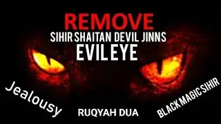Powerful Ruqyah for 🔥 Evil Eye & Stress Relief | Instant Quran Healing | 