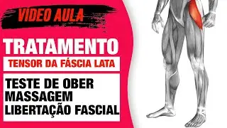 Massagem Encurtamento Tensor da Fáscia Lata Vídeo Aula