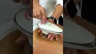 Zemits CelluGlide | Vacuum therapy with EMS and roller massage