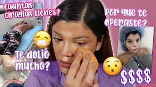 RESPONDIENDO PREGUNTAS SOBRE MIS CIRUGIAS!! 😰😷 | Quién me las pago? #ad