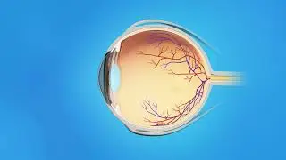 Retina BRVO Medication Injections