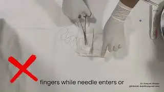 Needle Stick Injury (NSI Prevention) - Suturing Safely to avoid NSI