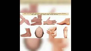 simple acupressure points for sleep/ insomnia