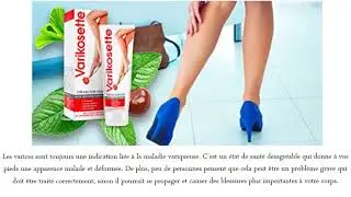 Varikosette Avis - Profitez de jambes saines et belles