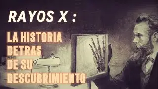 Rayos X: &iquest;Qui&eacute;n, C&oacute;mo y Cu&aacute;ndo los Descubri&oacute;? | Historia Completa de Wilhelm R&ouml;ntgen
