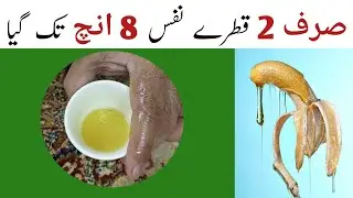 Homemade Onion And Mustard oil Recipe | Crispy Onion Recipe