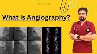 What Is Angiography and What Does It Do?