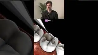 Filling A Tooth With Amalgam