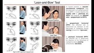Lean-and-Bow Test
